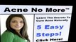 ACNE NO MORE REVIEW - Are You Curing Your ACNE or Making It WORSE? | HOME Remedies for ACNE