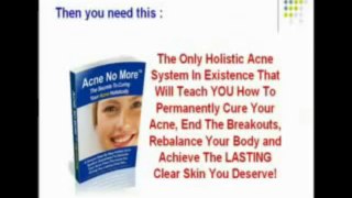Real Cure Acne No More Treatment