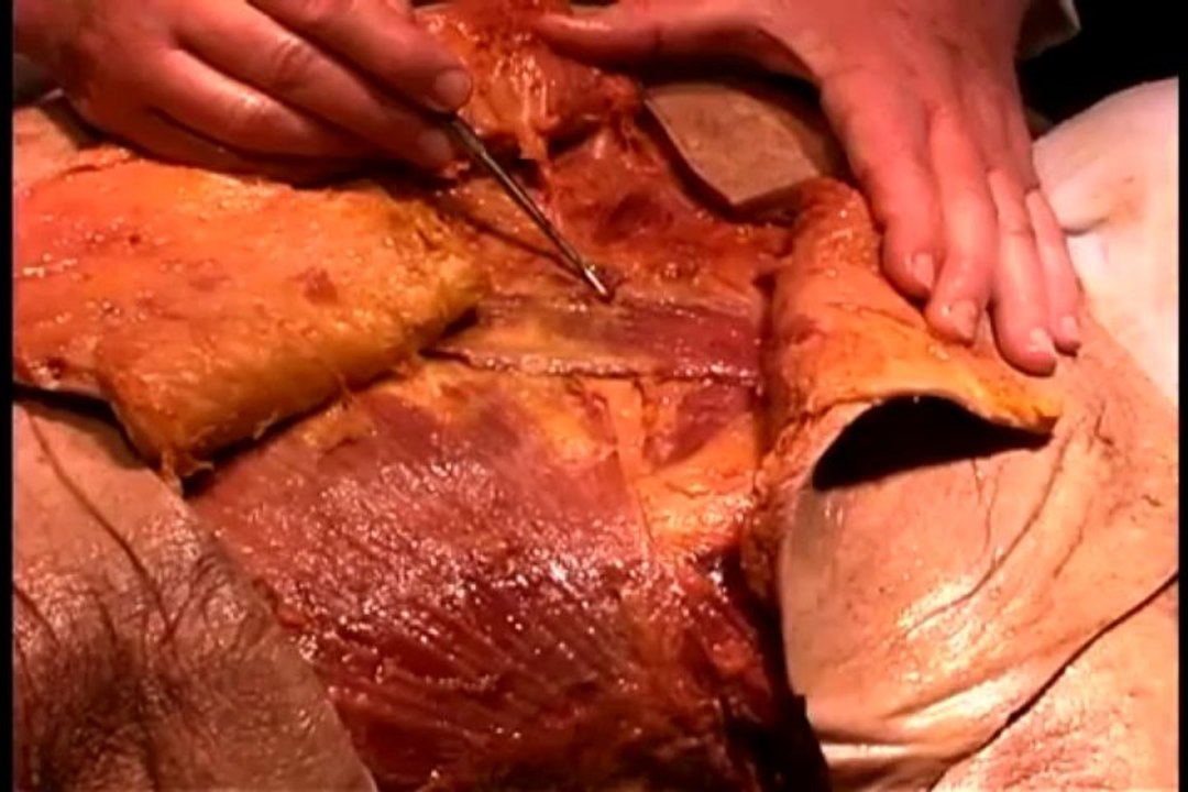 Human Anatomy Dissection 01 Superficial Thorax And Abdomen