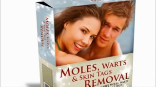 Moles Warts And Skin Tags Removal Review | Remove Moles, Warts & Skin Tags