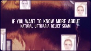 Natural Urticaria Relief SCAM -- Natural Urticaria Hives Treatment