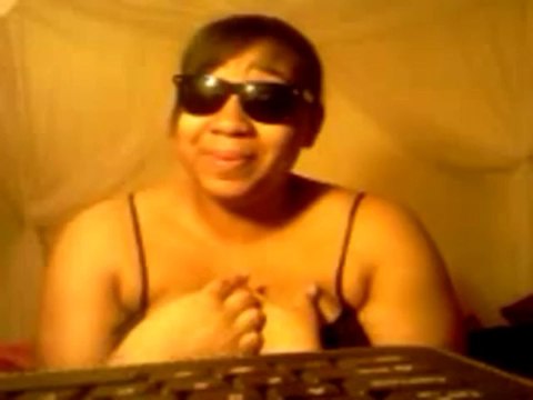 I cured my Vitiligo! Thanks to Michael Dawson & Natural Vitiligo Treatment System