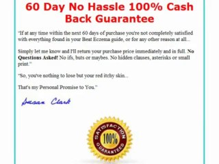Beat Eczema Review 2