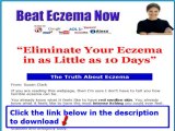 Beat Eczema Book Susan Clark   Beat Eczema Pdf Download