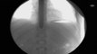 Sword-Swallower Dan Meyer X-ray Fluoroscope