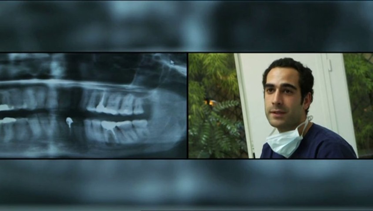 Dents et vieillissement prématuré du visage