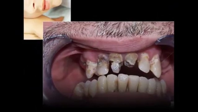 Affordable Dentistry Saskatoon - For Great Service Call (877) 732-9136