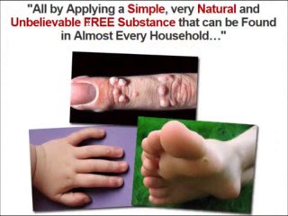 Combating Warts For Good Review – The Truth Exposed!