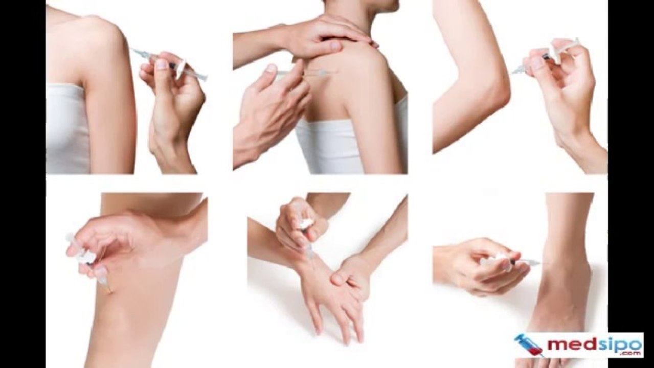 Synovial Fluid Analysis (Results Interpretation, Sample, Risks)