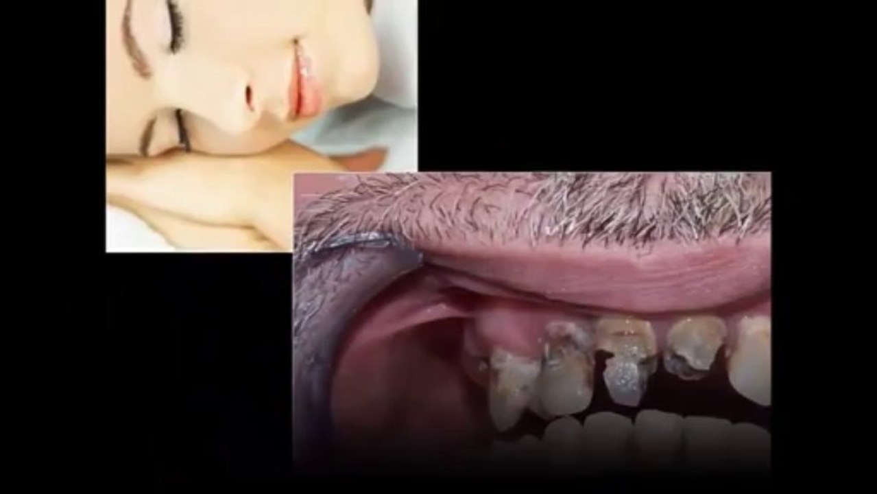 Cosmetic Dental Work Toronto - Call (877) 399-9477