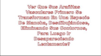 Como Se Quitan Las Varices