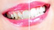 Cosmetic Dentist Manassas Park - Dental Implants, Sedation Dentistry, Veneers