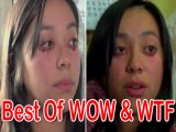 Best of Wow and Wtf A Girl Who Cries Tears Of Blood And More