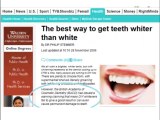 Learn how to get white teeth natural - Teeth whitening - Get a celebrity smile