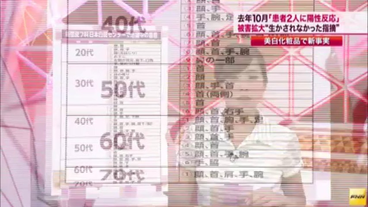 カネボウ美白化粧品「白斑」　2012年10月時点で皮膚科医が指摘