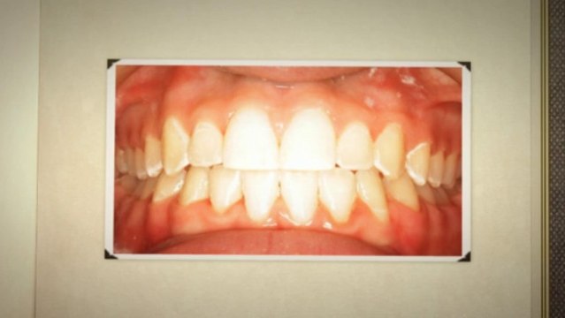 Dallas Orthodontists July2013