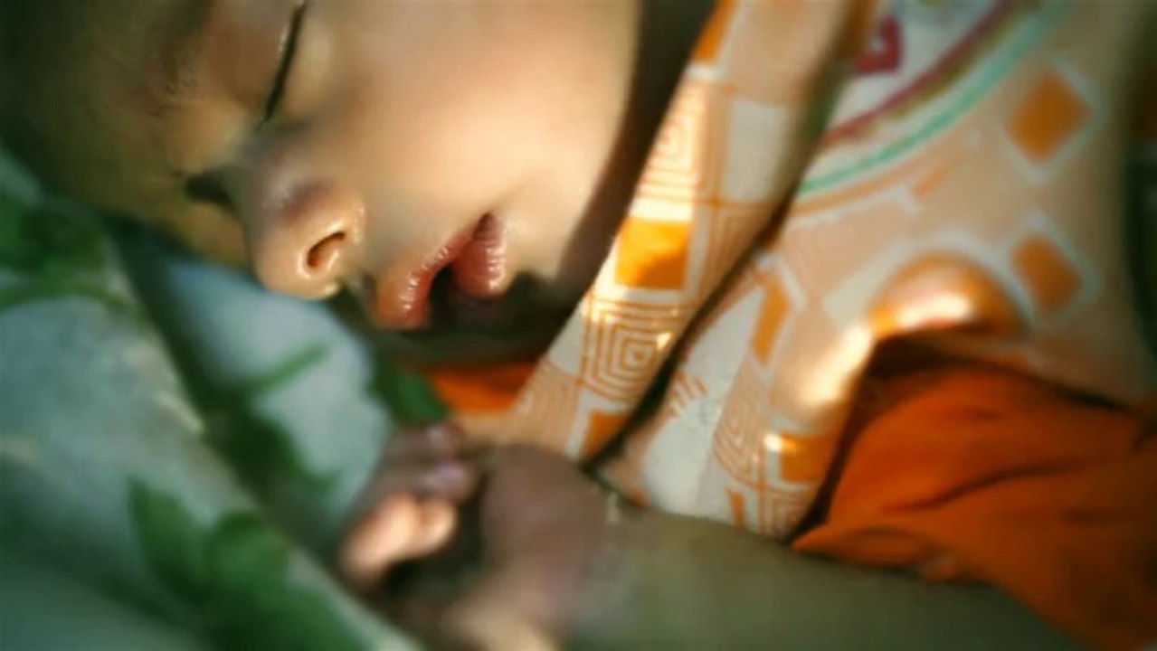 Malnutrition PSM - Haroon