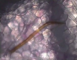 Piqure de moustique vue de l'intérieur