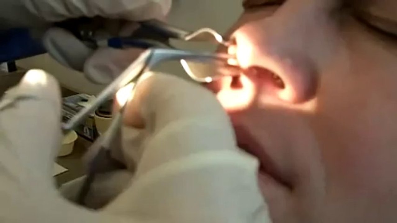 Big disgusting booger pulled out of nose
