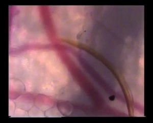 microscopic view of a Mosquito seeking for human blood!