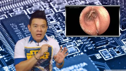 The SharkShows ตอนที่ 77