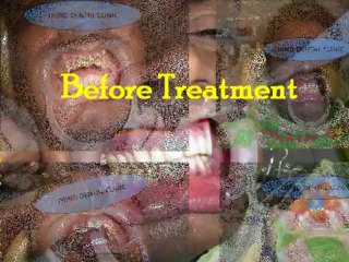 SMILE DESIGNING CASE