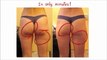 Cellulite Treatment - Best Cellulite Treatment To Get Rid Of Cellulite Naturally