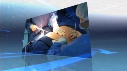 Chirurgie Esthétique en Tunisie