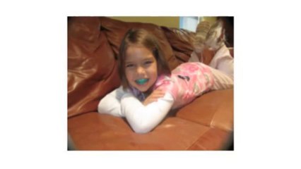 MyoBrace Braces Grandview TX