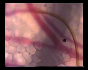 Un moustique qui pique vu au microscope