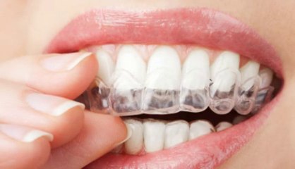 Get That Sparkling Smile With The Help Of Cosmetic Dentistry!