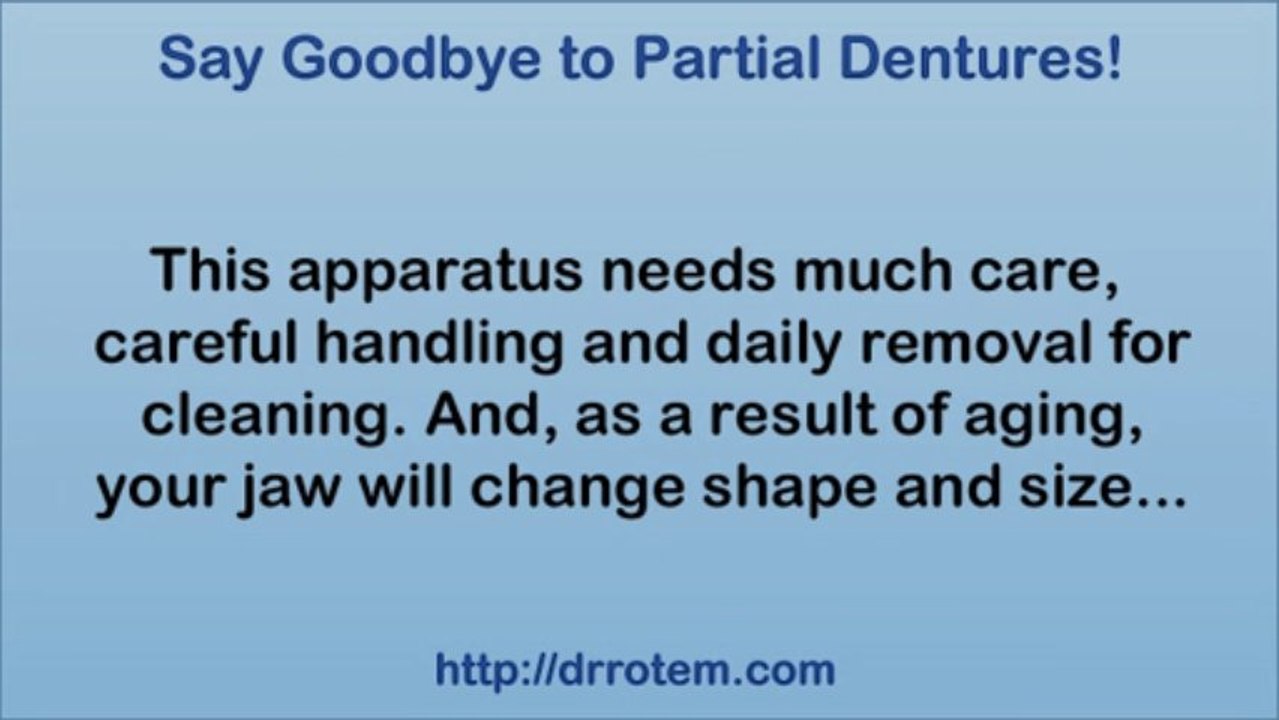 Moving from Partial Dentures to Dental Implants
