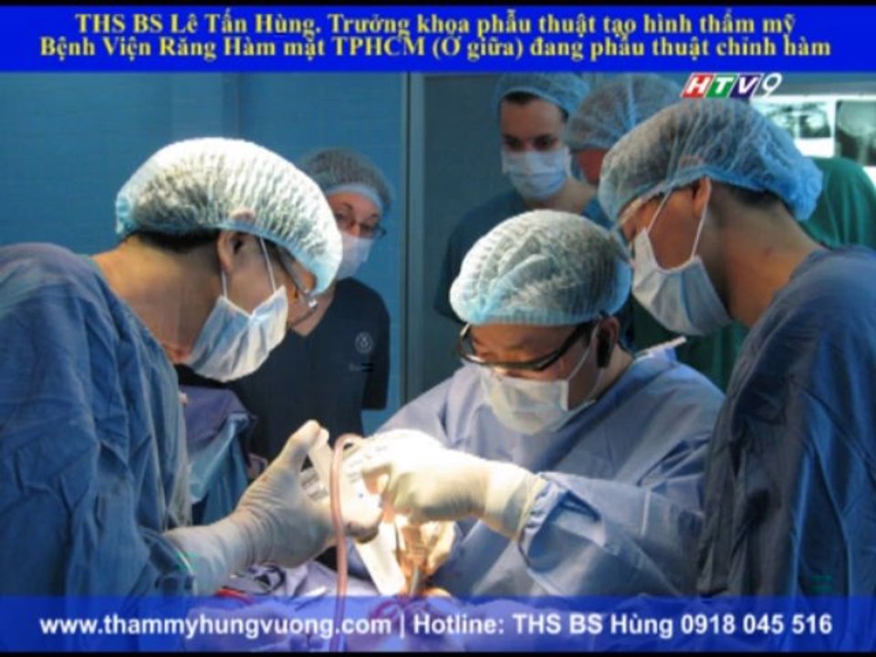 Phẫu thuật gọt hàm | Chỉnh hình răng hàm hô - móm - vẩu | THS BS Lê Tấn Hùng