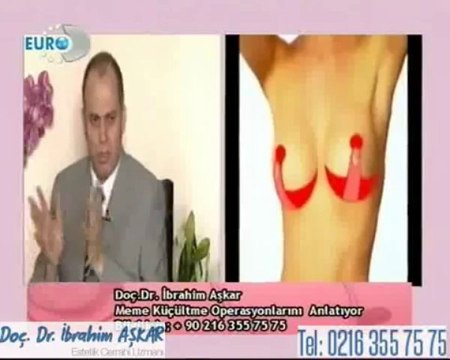 Meme küçültme ameliyatında kişide deride genetik bir hastalık varsa ne tür bir çalışma yapılır