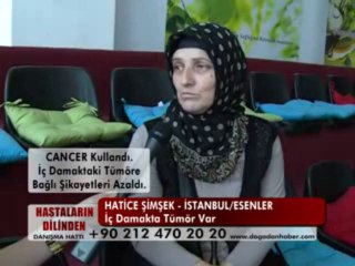 HATİCE ŞİMŞEK ( İÇ DAMAKTA TÜMÖR )