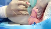 Stem Cell Therapy Web Segment #3 | Stem Cell Treatment in Orlando
