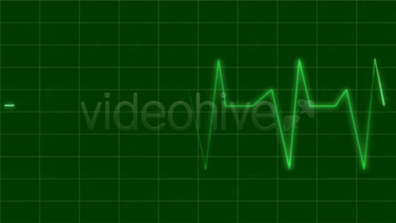 After Effects Project Files - EKG - VideoHive