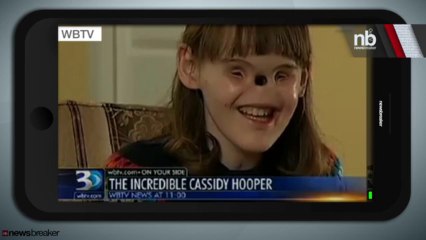 Choc ! Une fille née sans nez et sans yeux