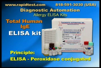 Total Human IgE ELISA kit