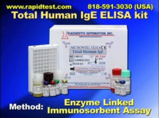Total Human IgE ELISA kit