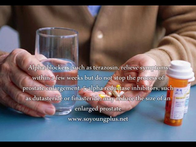 Best BPH Medicines – What Is The Best BPH Medicines