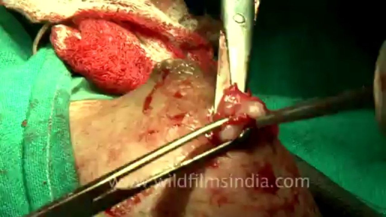 Surgery