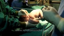 Caesarean section delivery-6