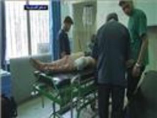 تزايد عمليات بتر الأطراف في سوريا