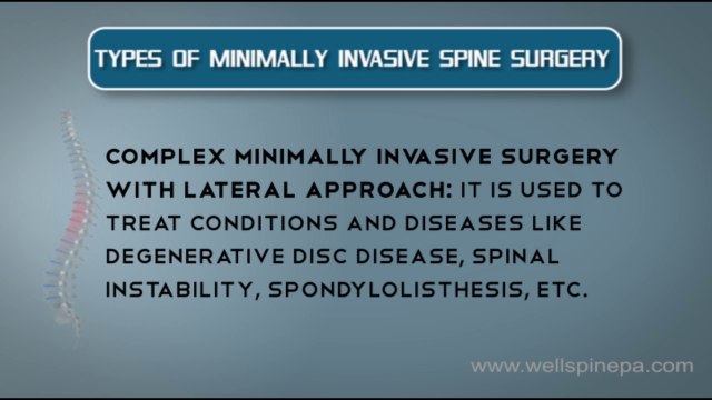 Various types of Minimally Invasive Spine Treatment