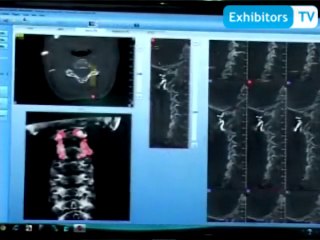 NewTom Cone Beam 3D Imaging – Italy introduced "NewTom 5G" for clinical applications  (Exhibitors TV @ Arab Health 2014)