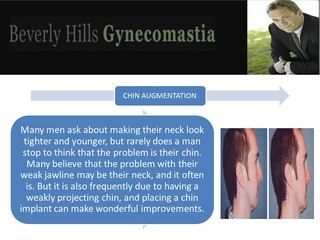 Steven Teitelbaum MD FACS : Gynecomastia Surgeon In Santa Monica