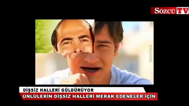 Ünlülerin dişsiz halleri görenleri güldürüyor