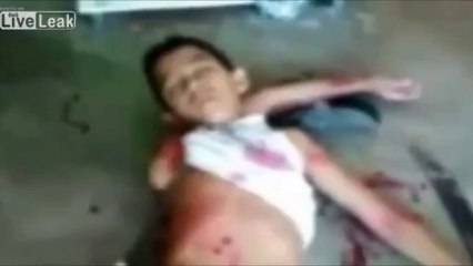 PALLYWOOD en Syrie : un enfant ressuscite !