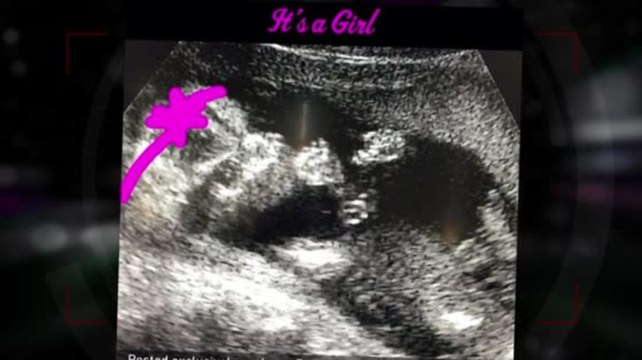 Kevin Jonas and Wife Danielle Are Having A Girl!